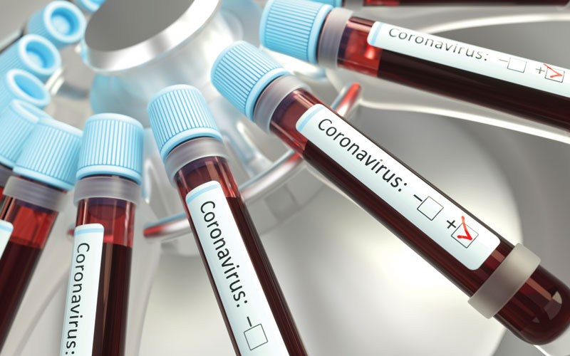 coronavirus