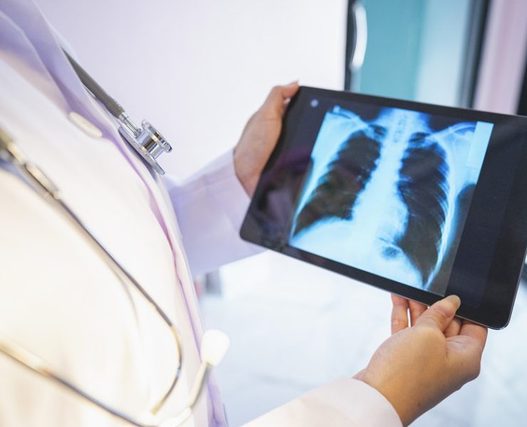 Little-known lung Infection grabs limelight from Covid, RSV Image Getty Images