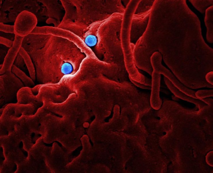 Man tests positive for MERS virus in UAE,